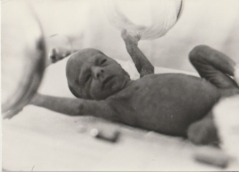 Bébé prématuré…